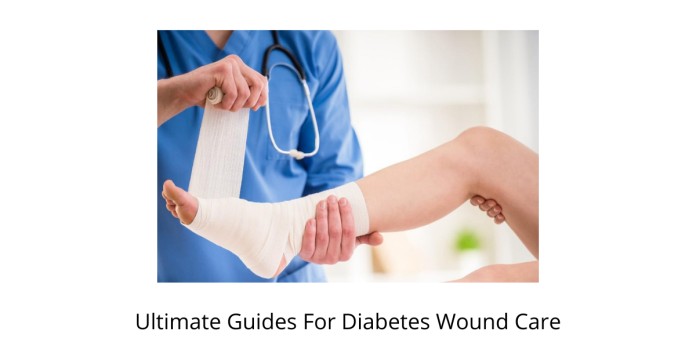 Ultimate Guides For Diabetes Wound Care