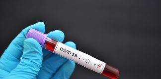 RT PCR test Covid 19