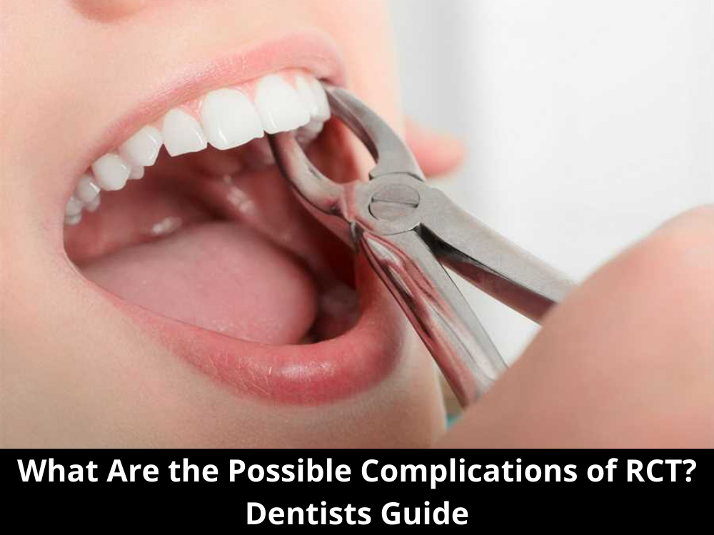 What Are the Possible Complications of RCT Dentists Guide