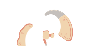 Bernafon hearing aids