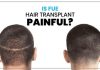 Is hair transplant painful or not