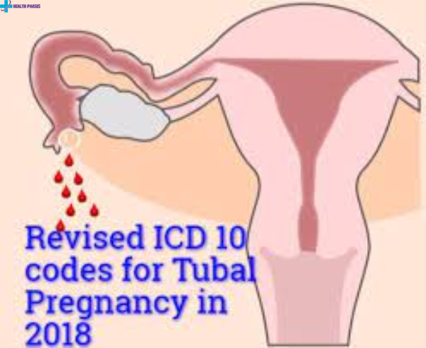 Intrauterine Pregnancy Icd 10